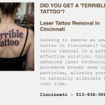 Laser Tattoo Removal
