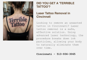 Laser Tattoo Removal